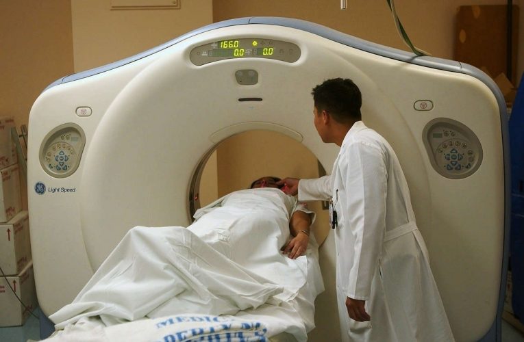 Brain CT scan